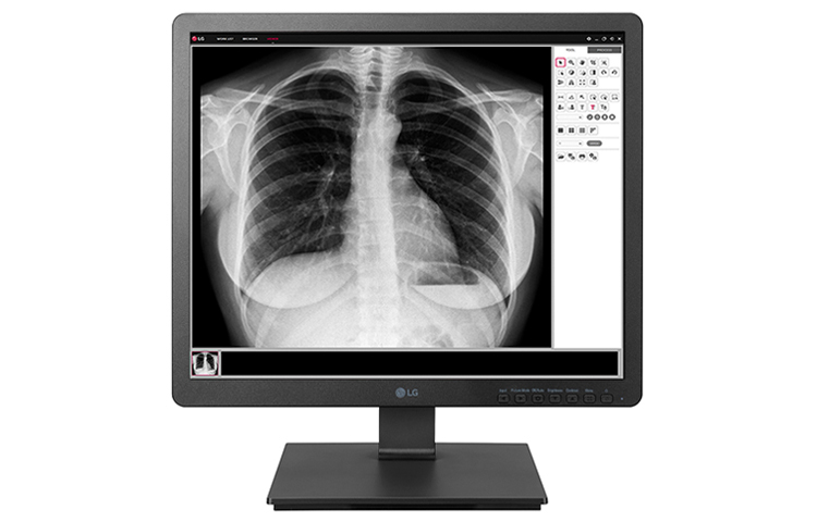 LG 19" 19HK312C-B LCD Medical DVI HDMI DP USB 3.0