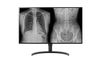 LG 32HL512D-M computer monitor 80 cm (31.5") 3840 x 2160 Pixels Full HD Zwart