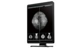Medigenic Befundmonitor 21.3" MSS500   2000:1   5MP  DVI/DP